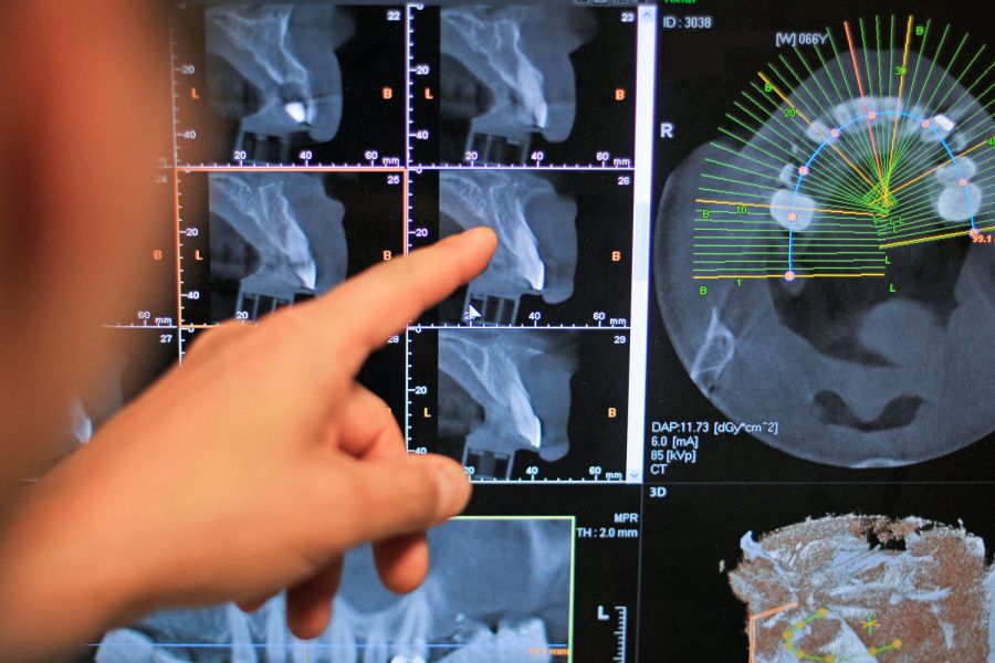 Auswertung Röntgenbild Kiefer